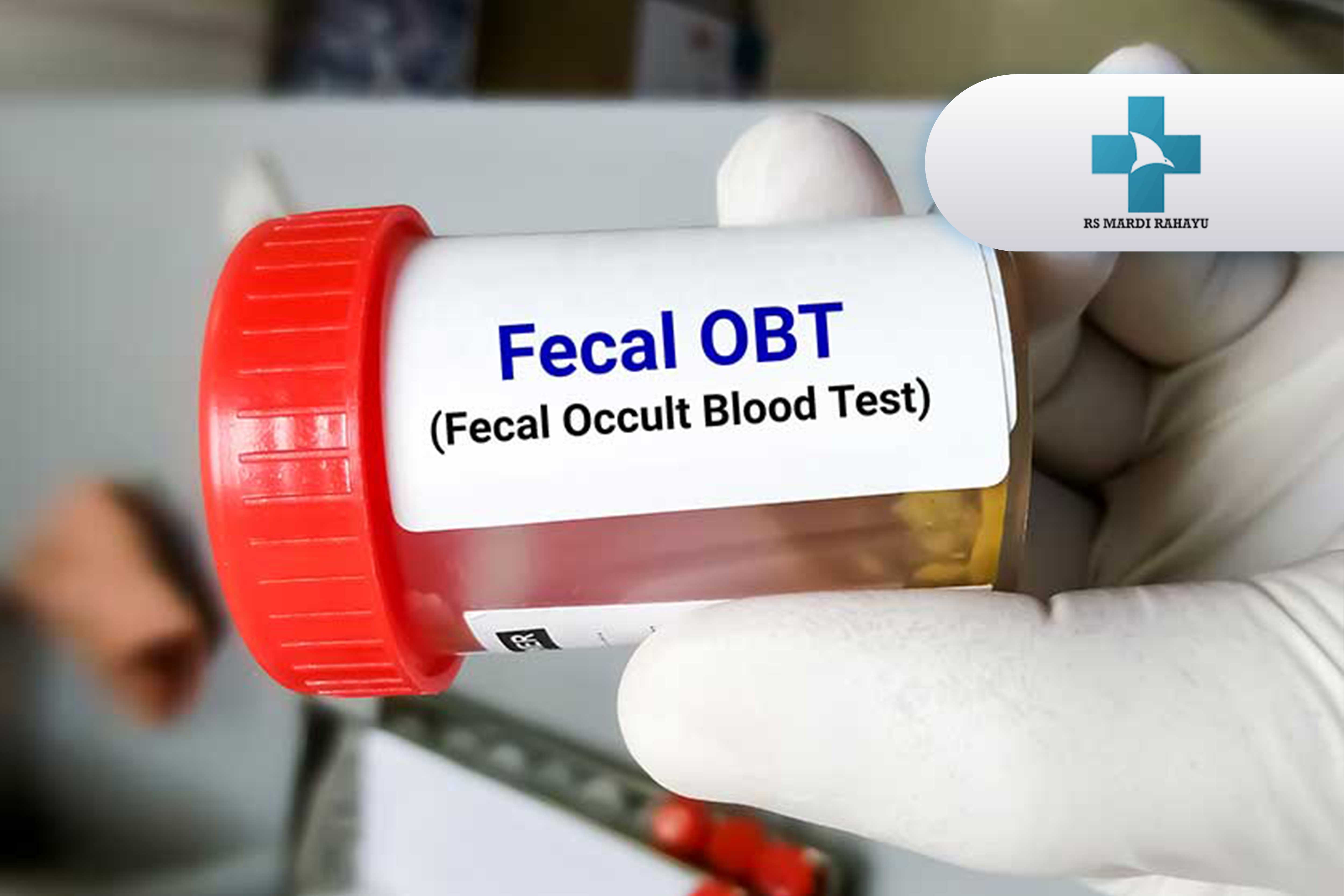 FOBT (Fecal Occult Blood Test)