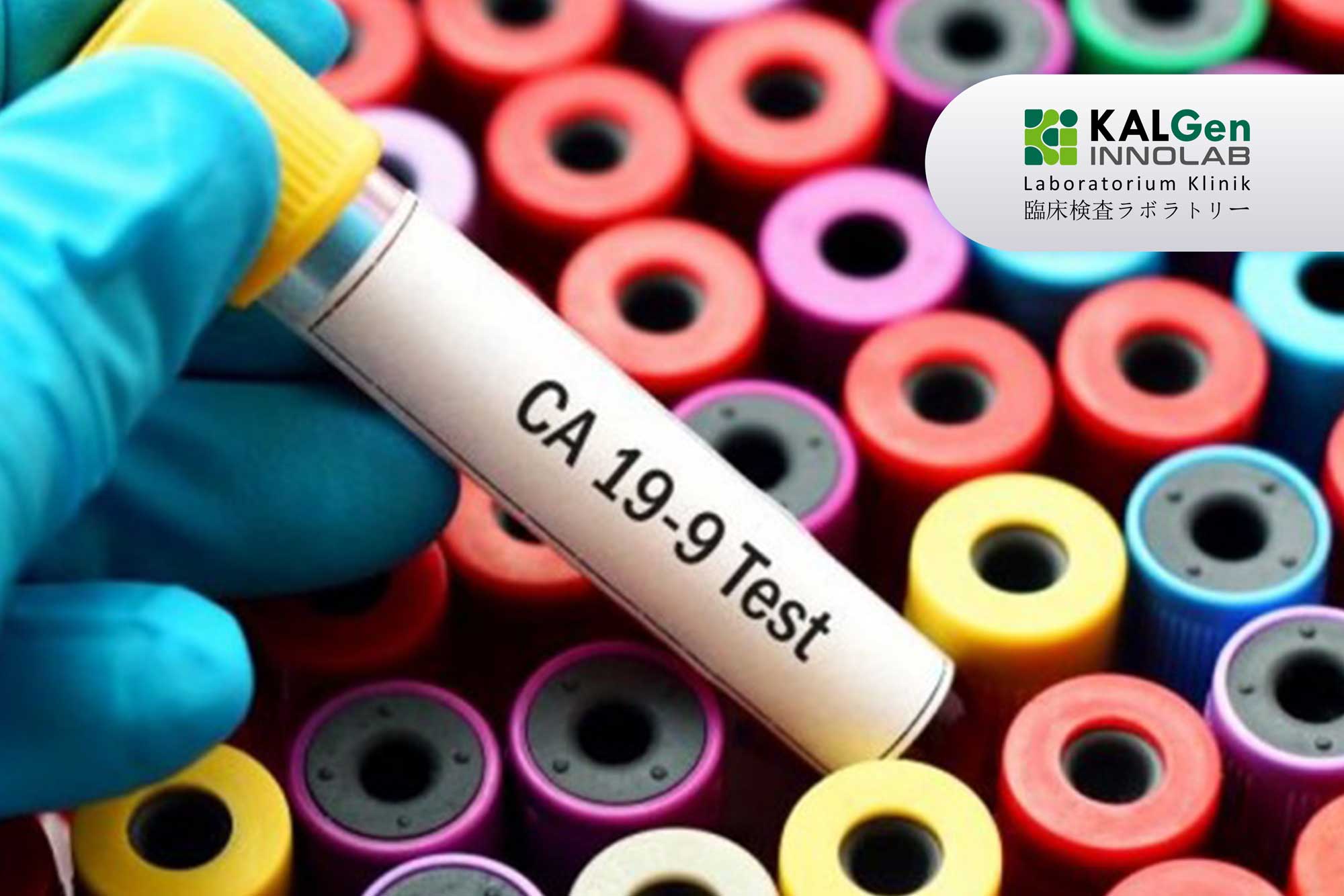 https://api.oneonco.co.id/storage/photo/product/Panel-Tumor-Marker-4_1678864645.jpg