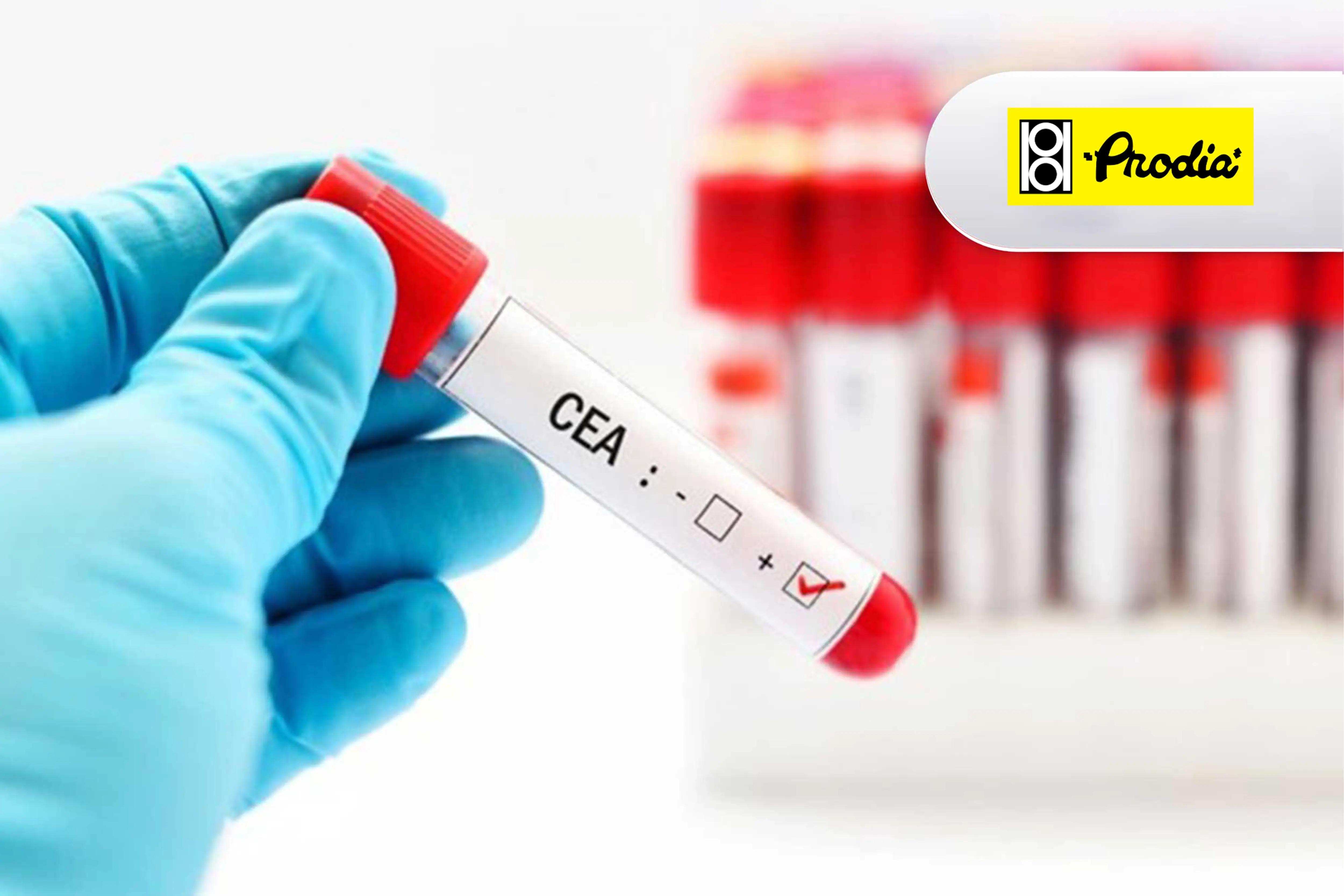 https://api.oneonco.co.id/storage/photo/product/Prodia-CEA_1735201148.webp