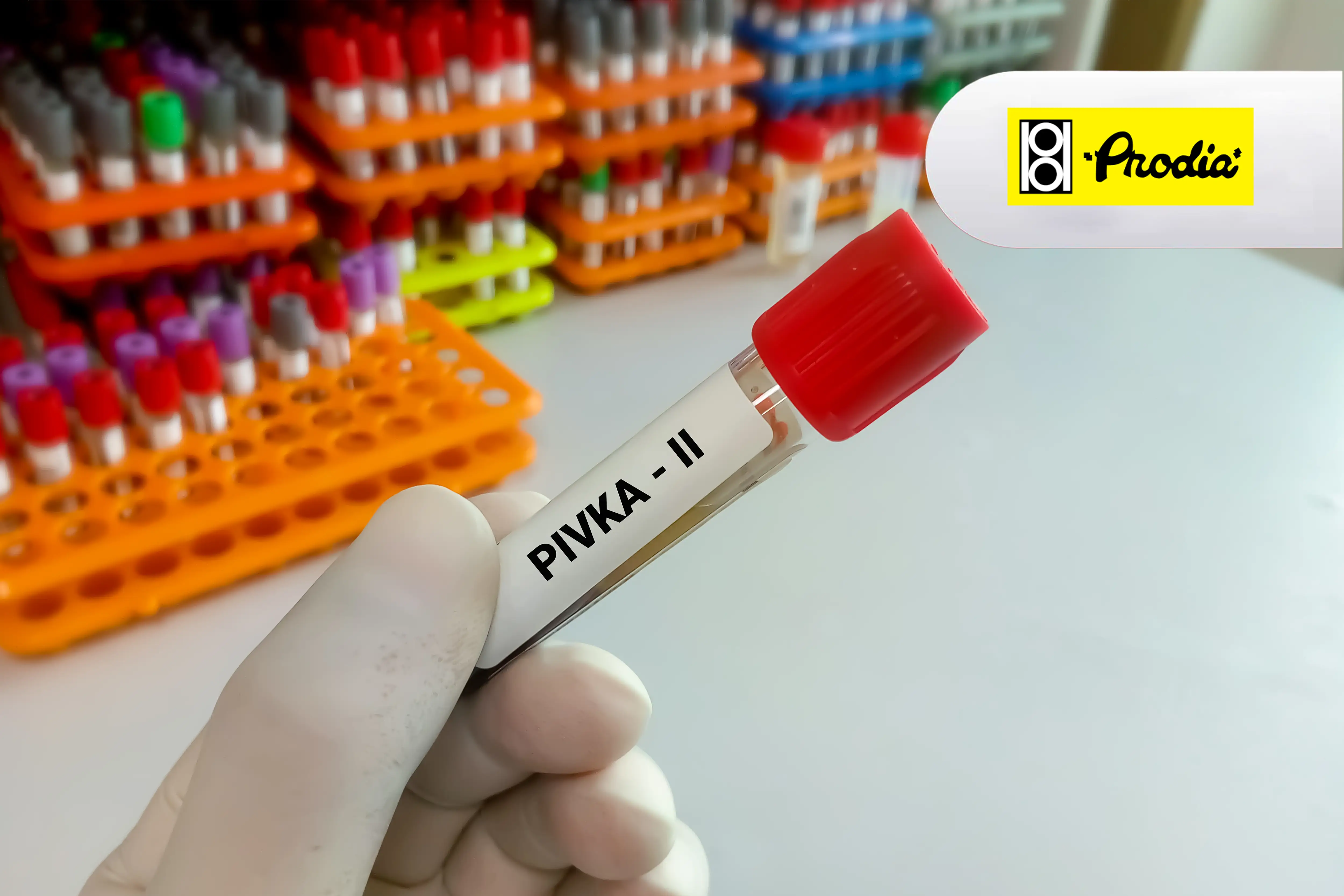 https://api.oneonco.co.id/storage/photo/product/Prodia-PIVKA-II_1743149318.webp