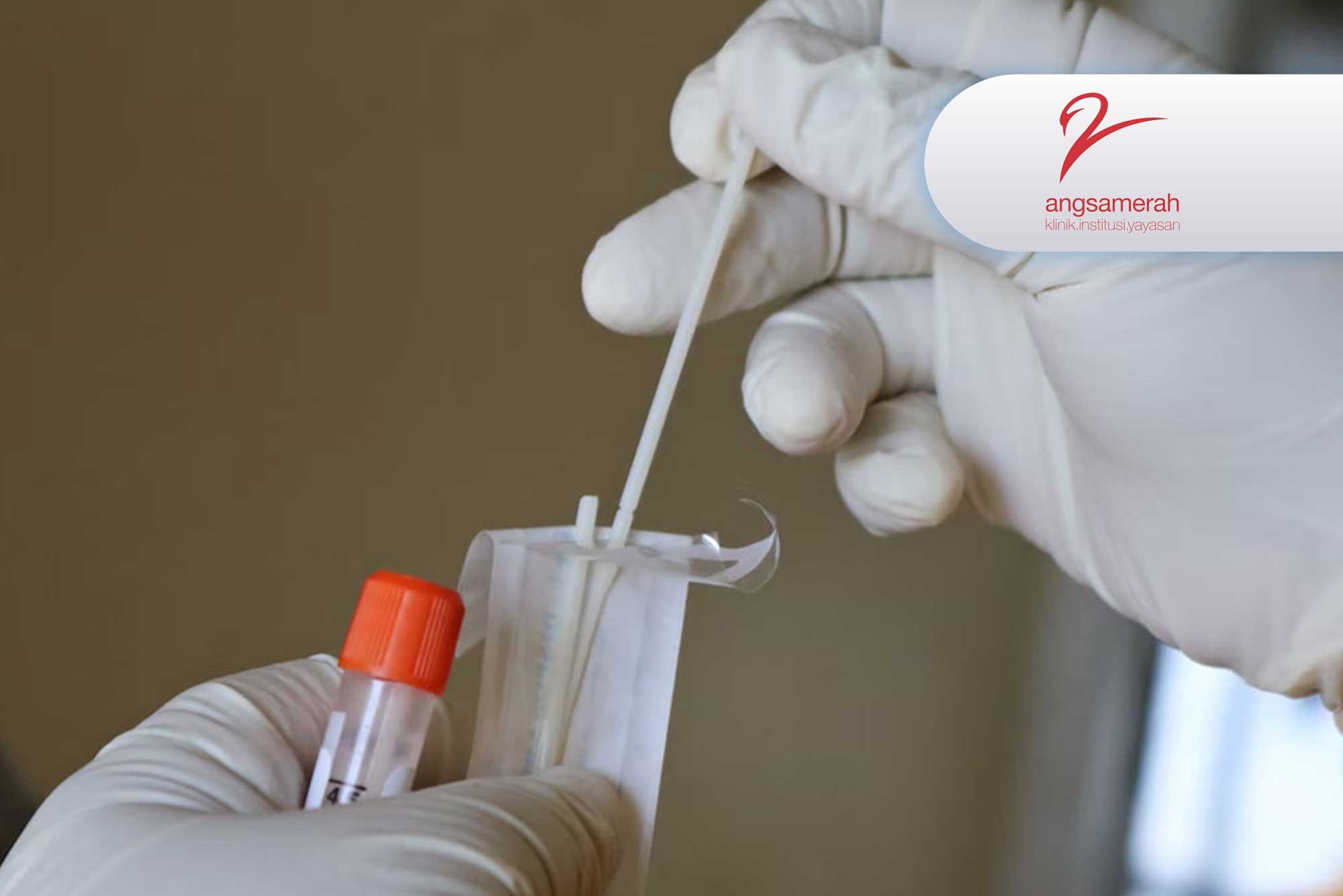 https://api.oneonco.co.id/storage/photo/product/hpv-dna-genotyping-350-angsamerah_1680163823.jpg